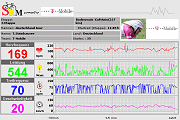 T-Mobile live SRM telemetry